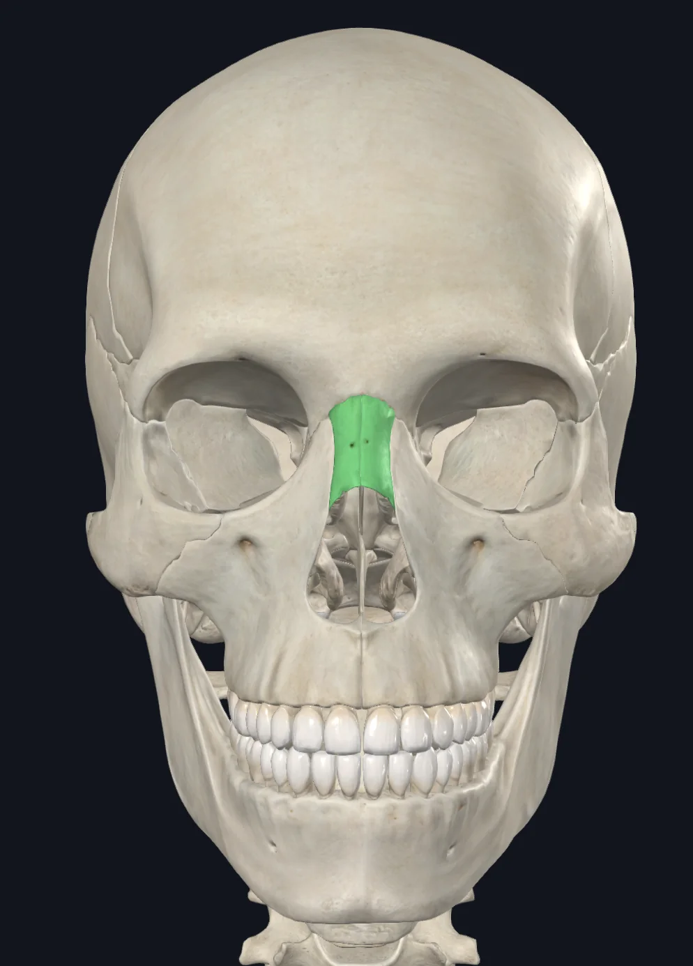 Nasal Bones