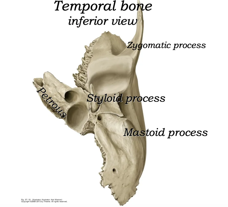 Temporal inferior
