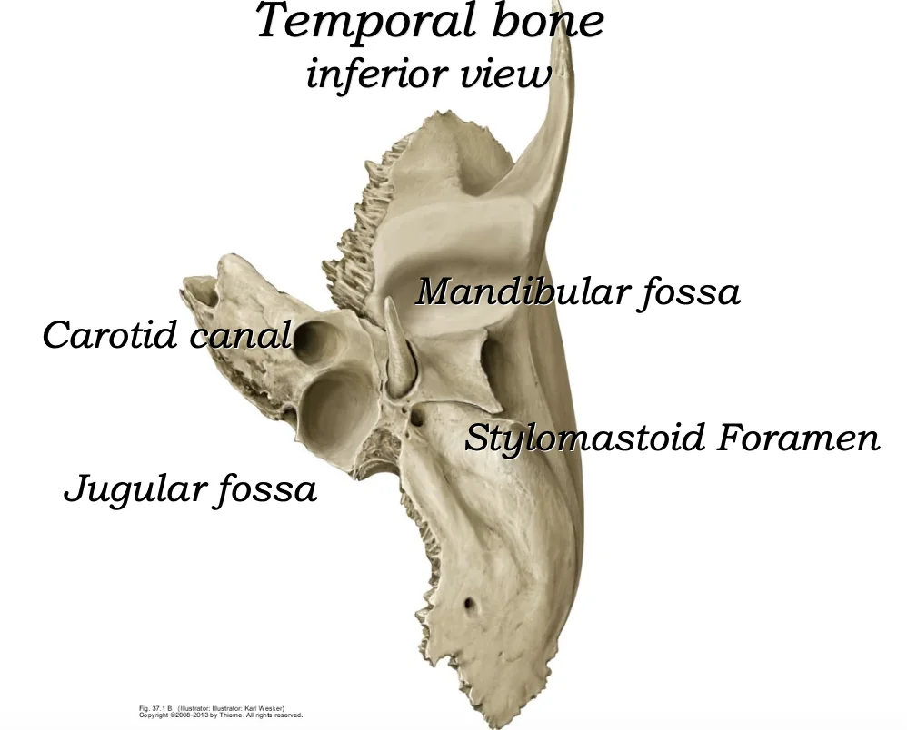 Temporal inferior