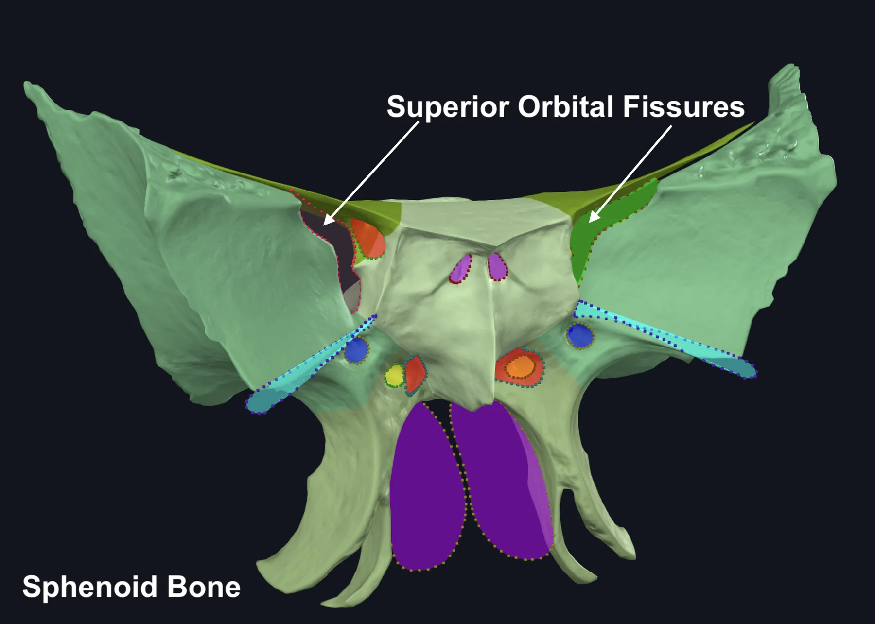 Superior Orbital Fissure