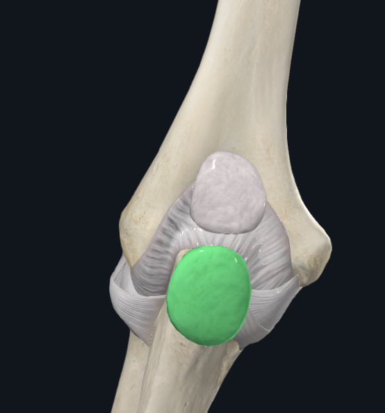 Subcutaneous Olecranon Bursa (Left)