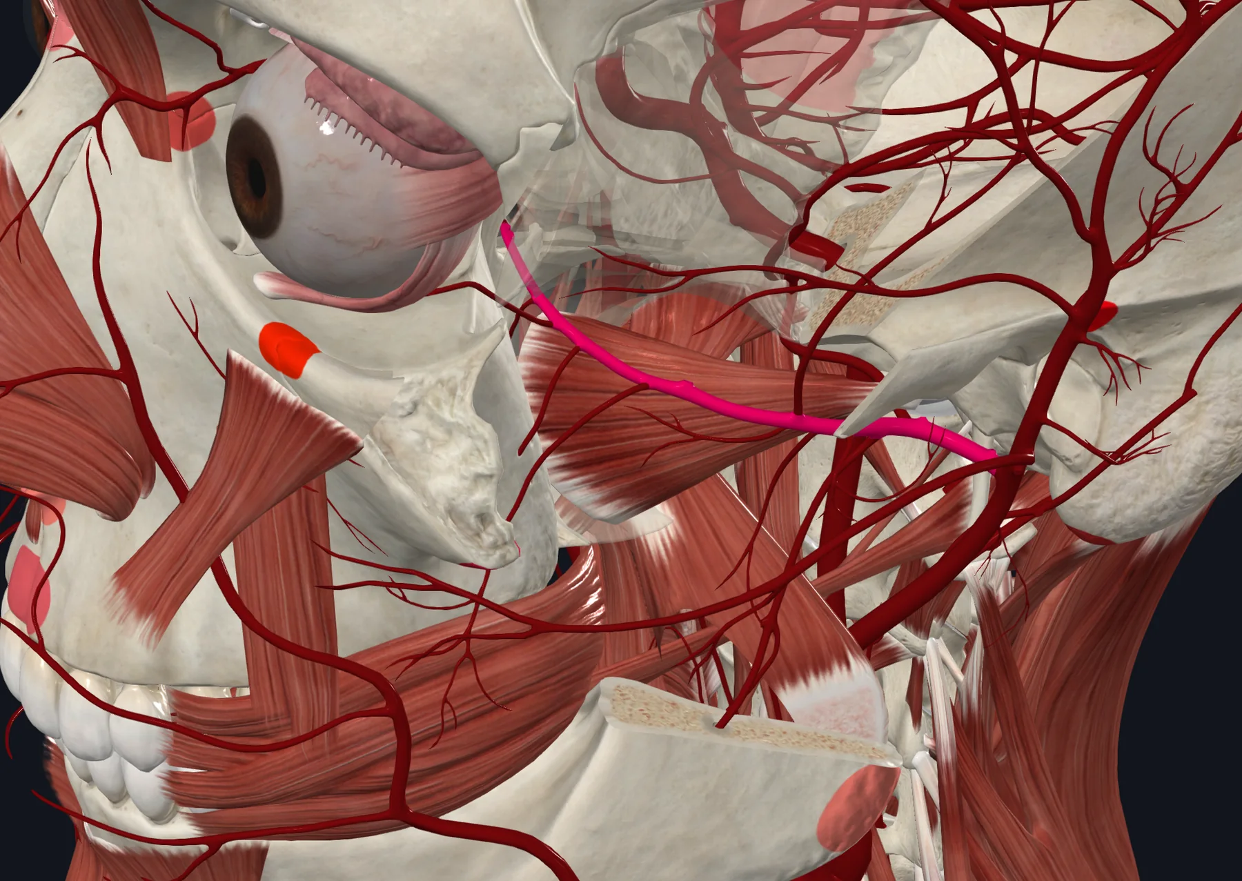 Maxillary Artery