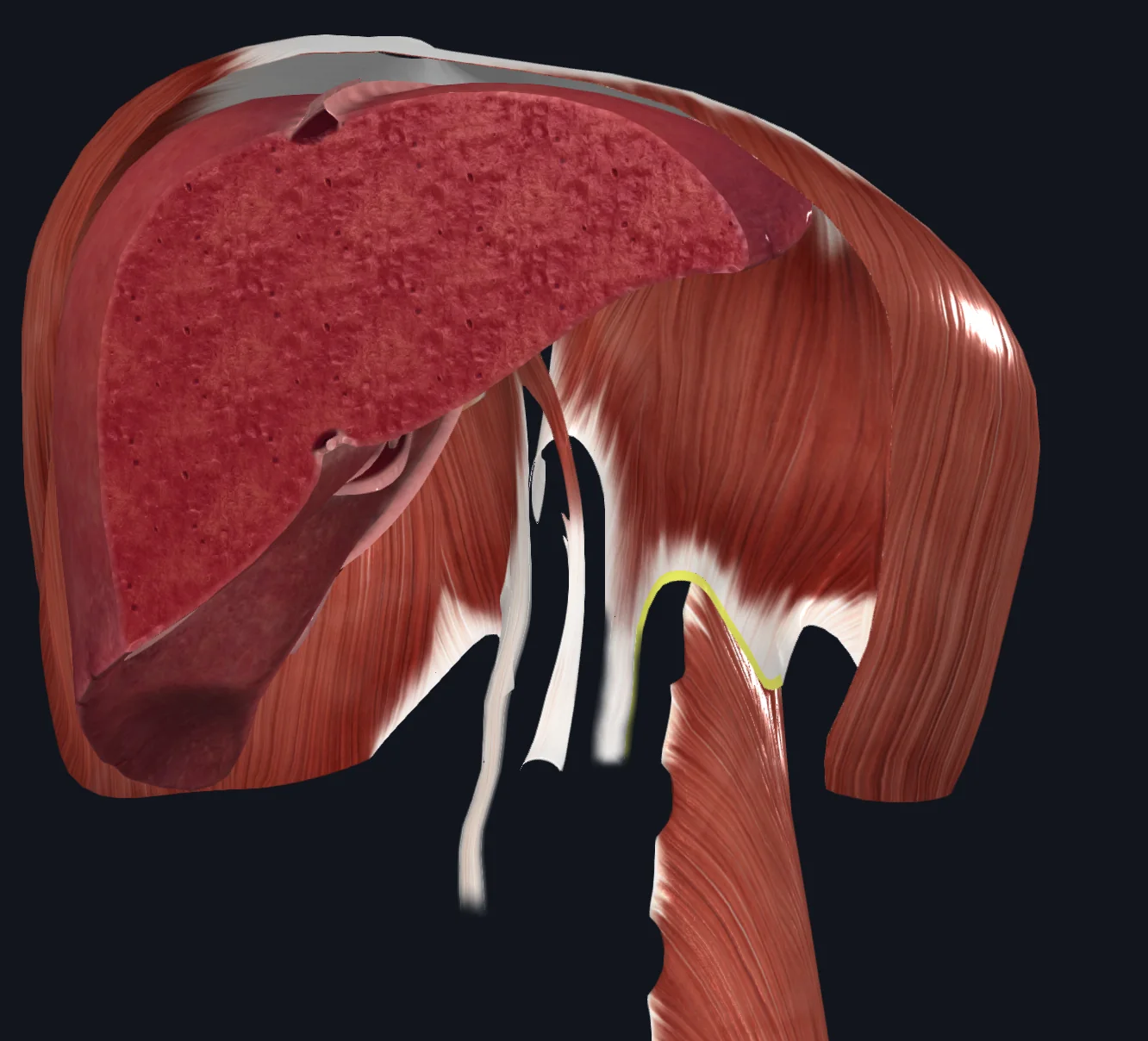 Medial Arcuate Ligament