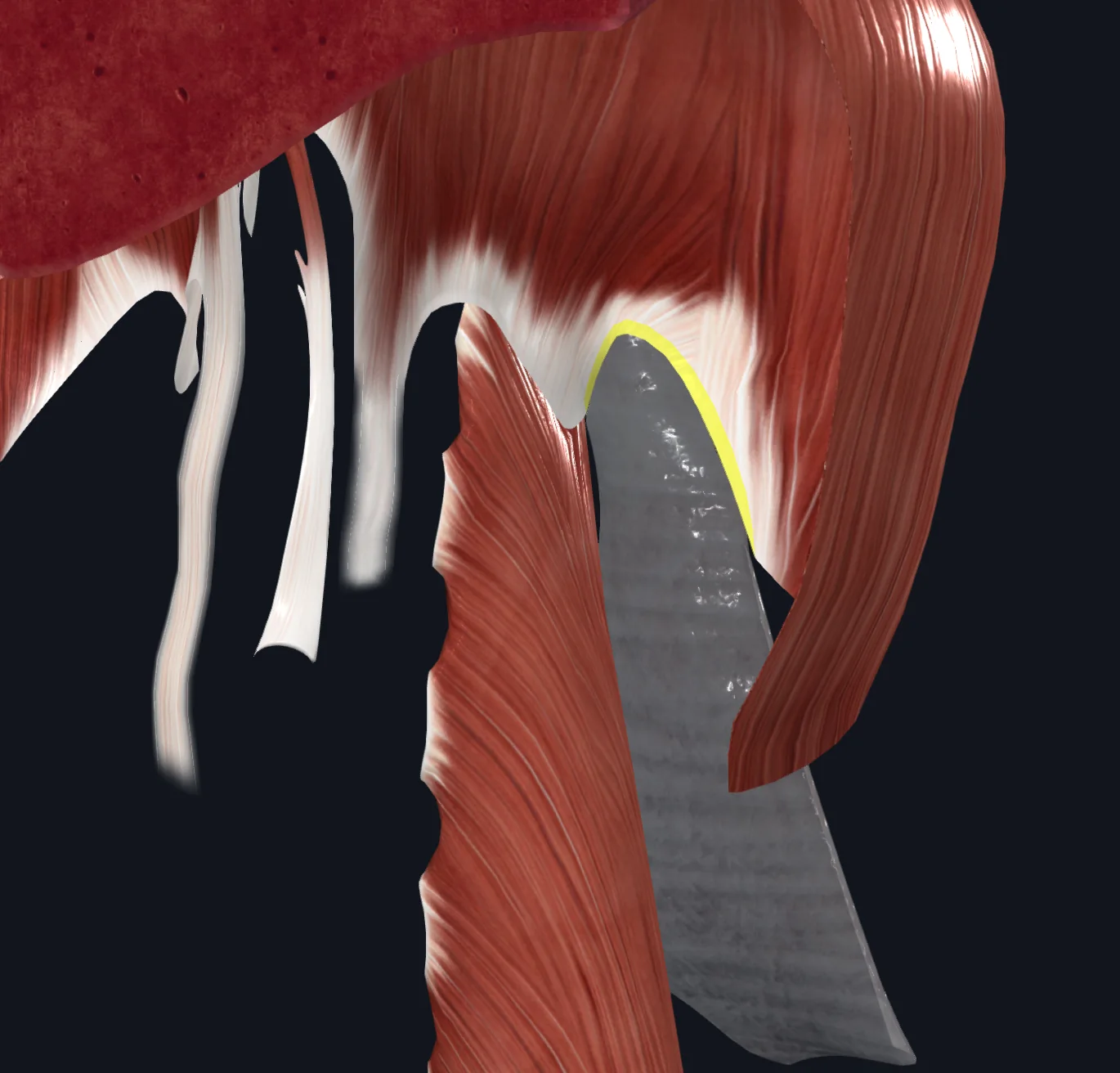 Lateral Arcuate Ligament