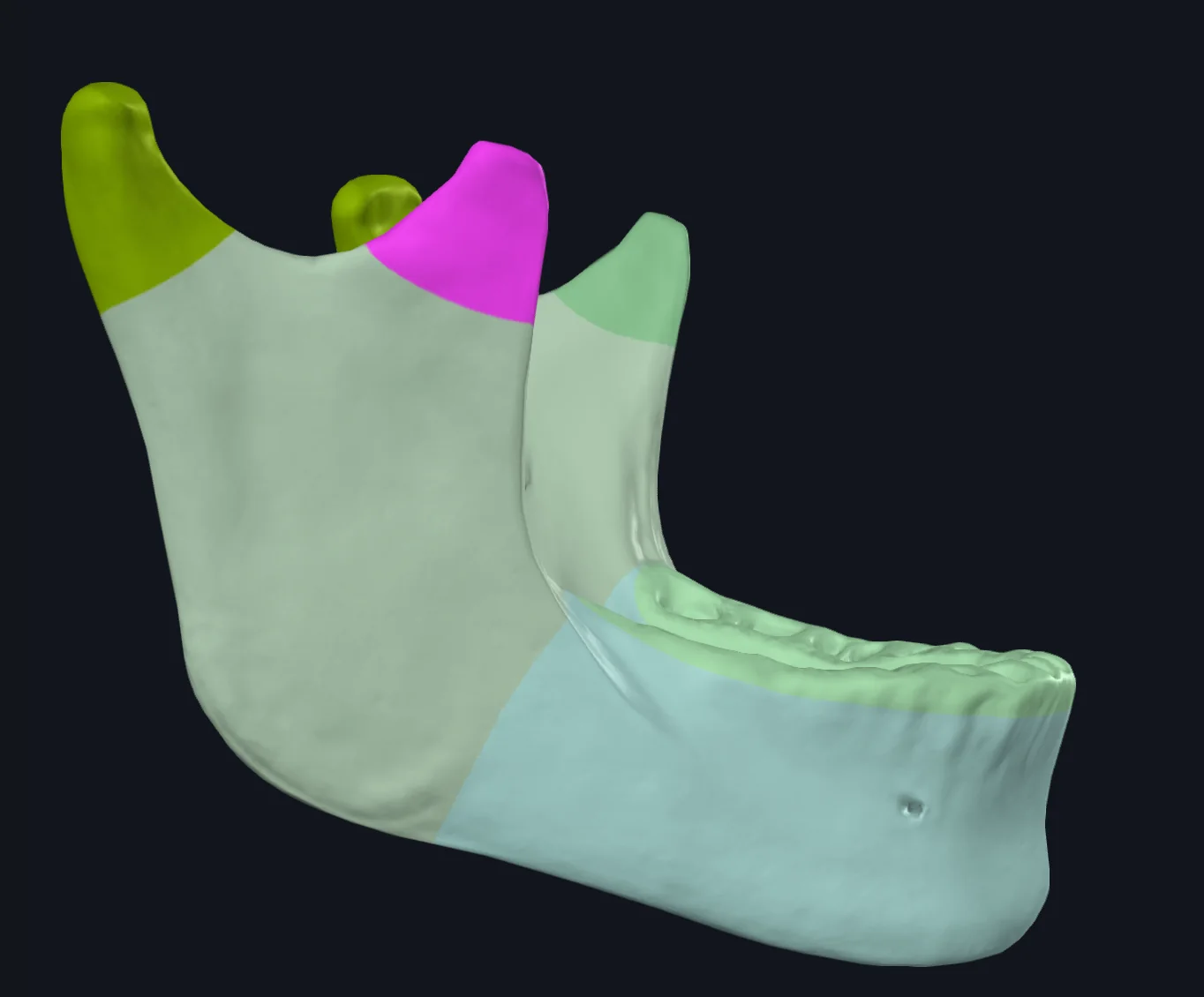 Coronoid Process
