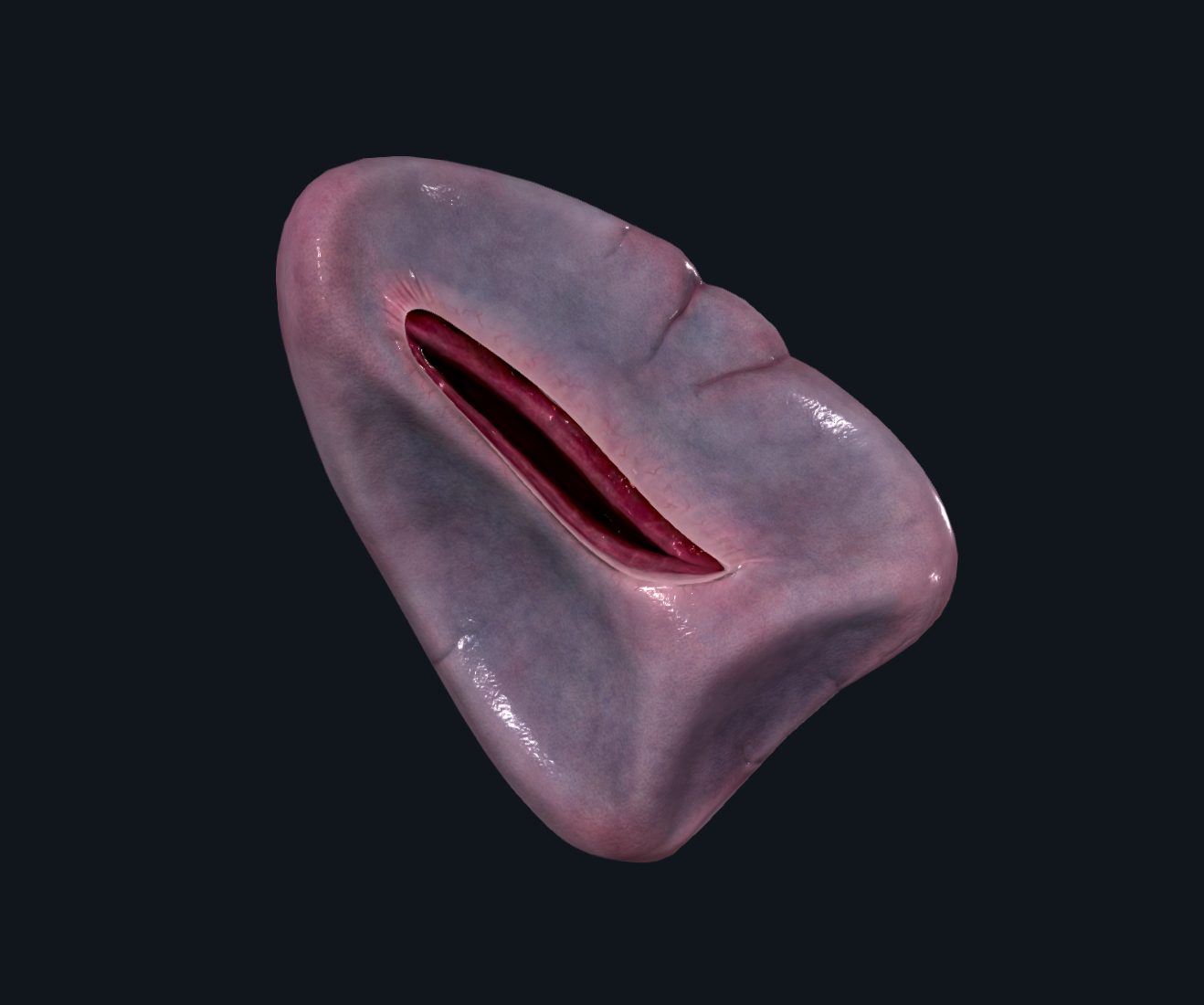 Spleen - טחול
