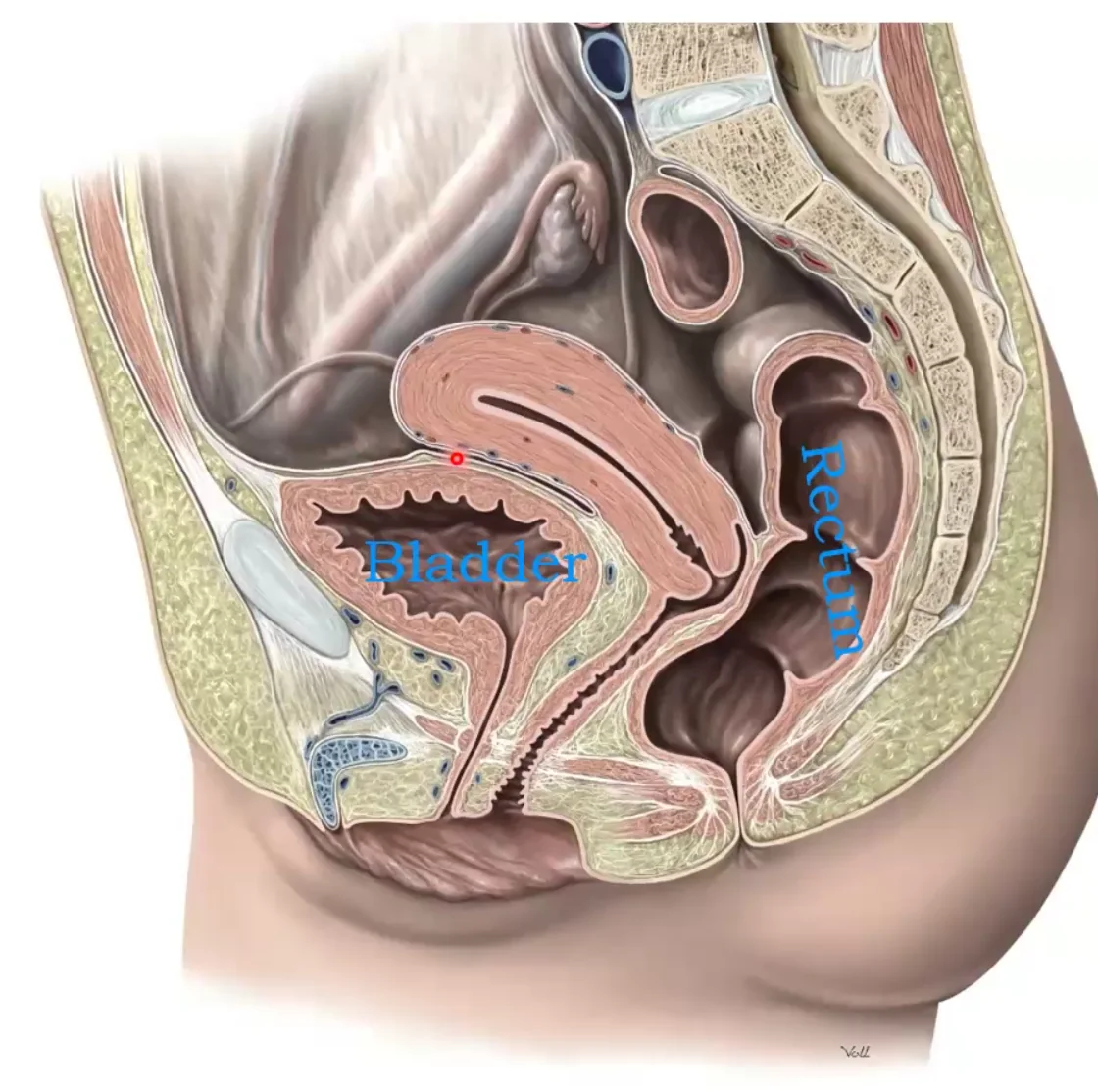 Utero-vesical Pouch