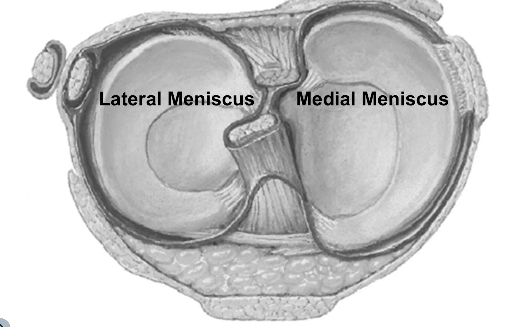 Meniscus