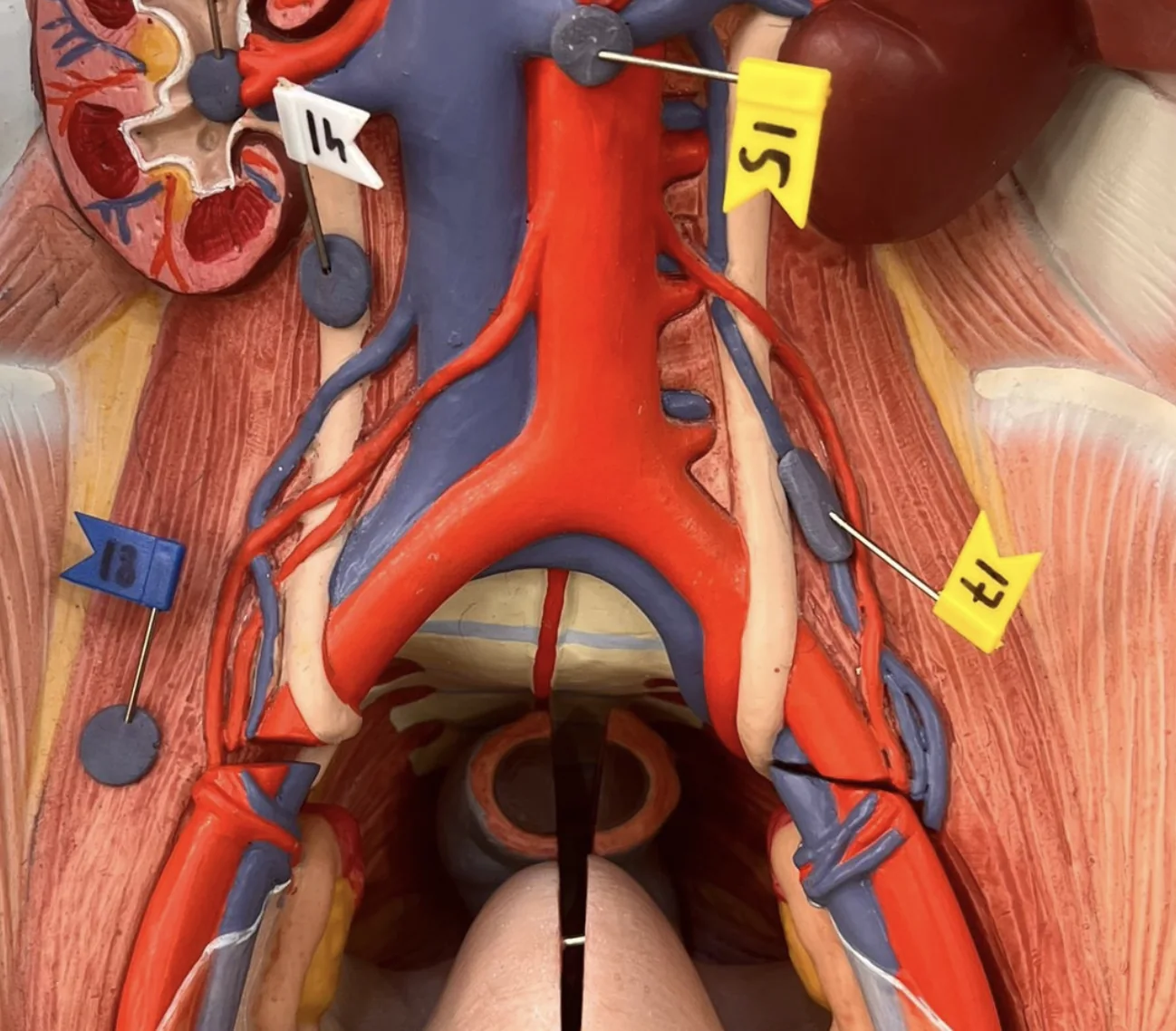 Ovarian vein (17)