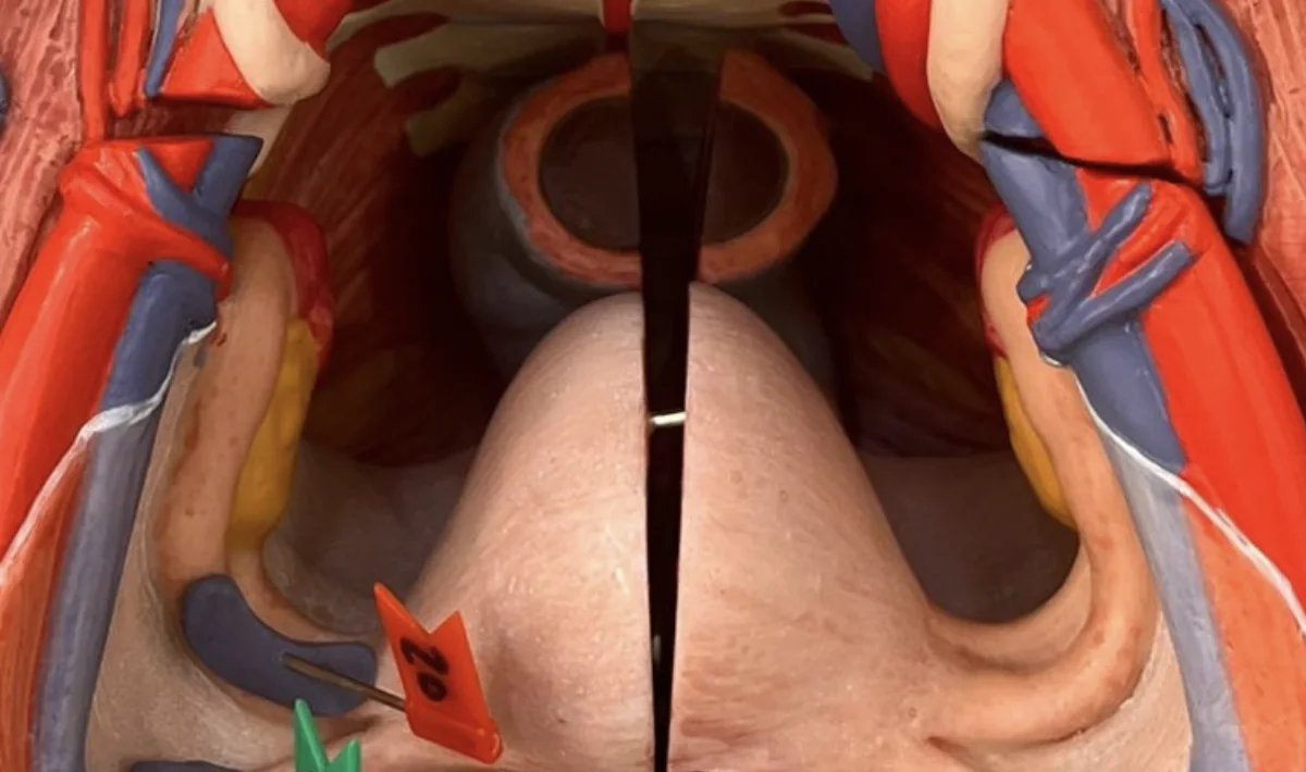 Uterine tube (20)