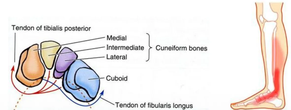 Tibialis Posterior Syndrome