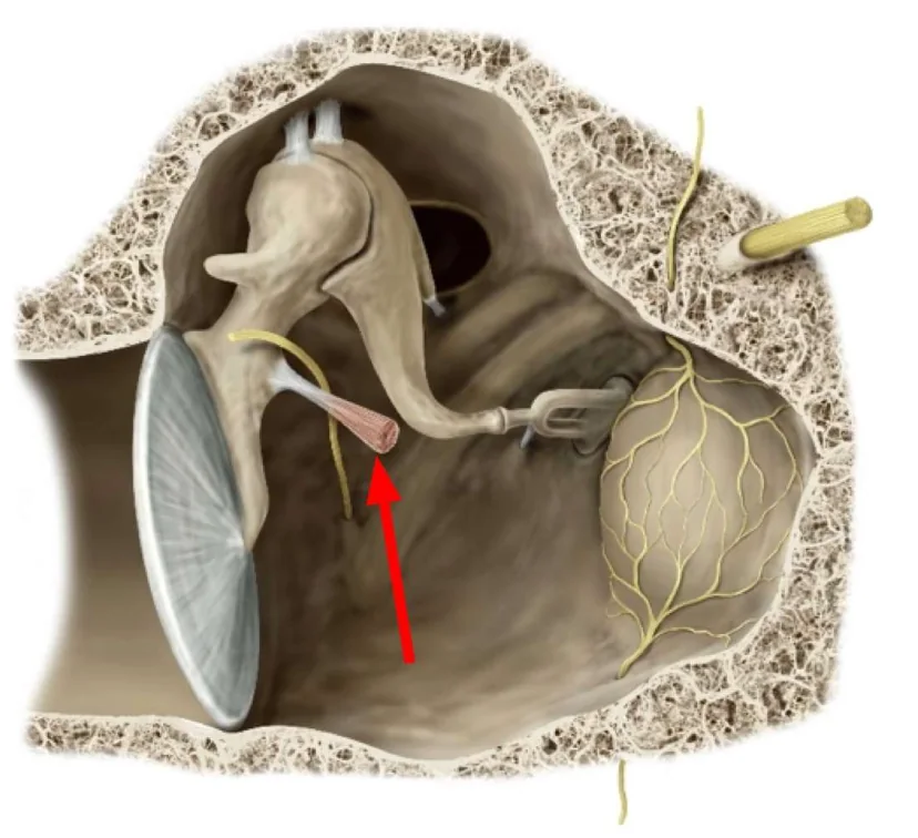 Tensor Tympani muscle