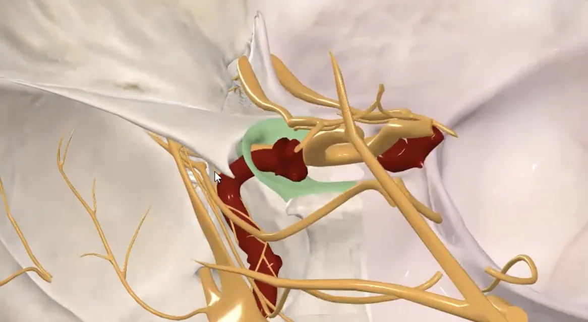Superior orbital fissure