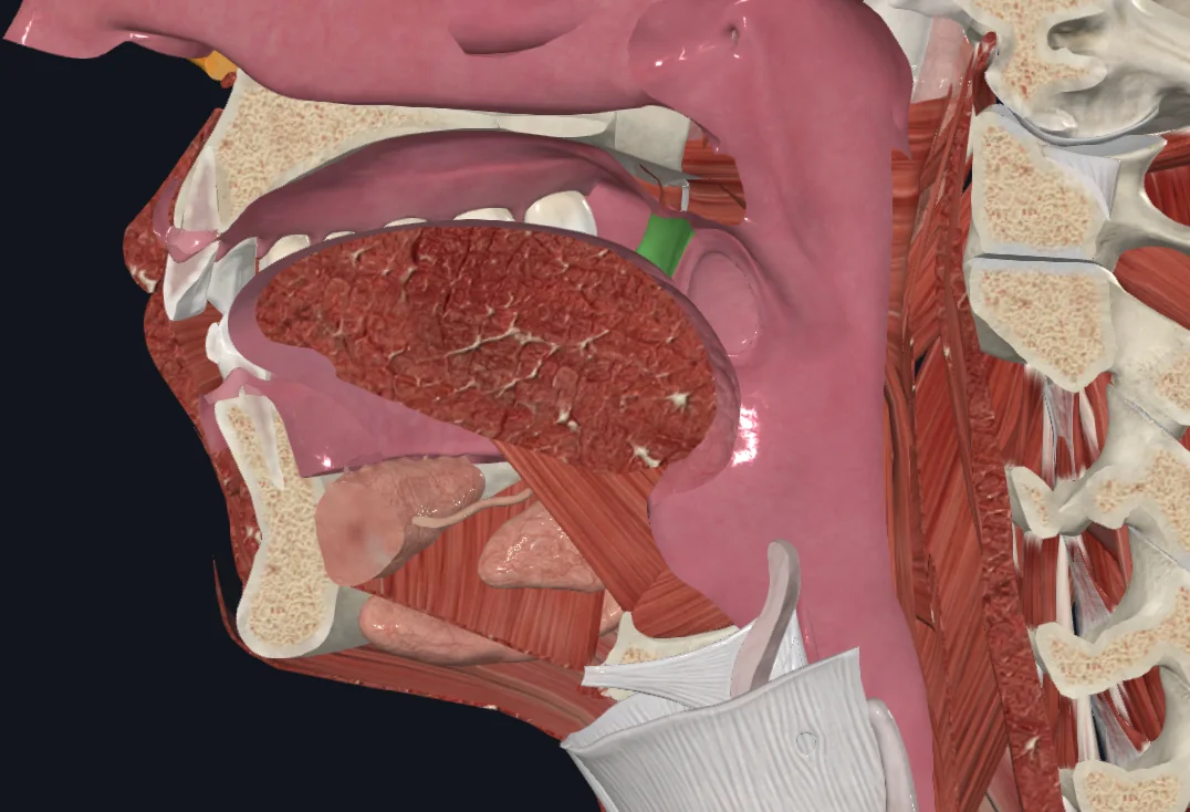Palatoglossal arch