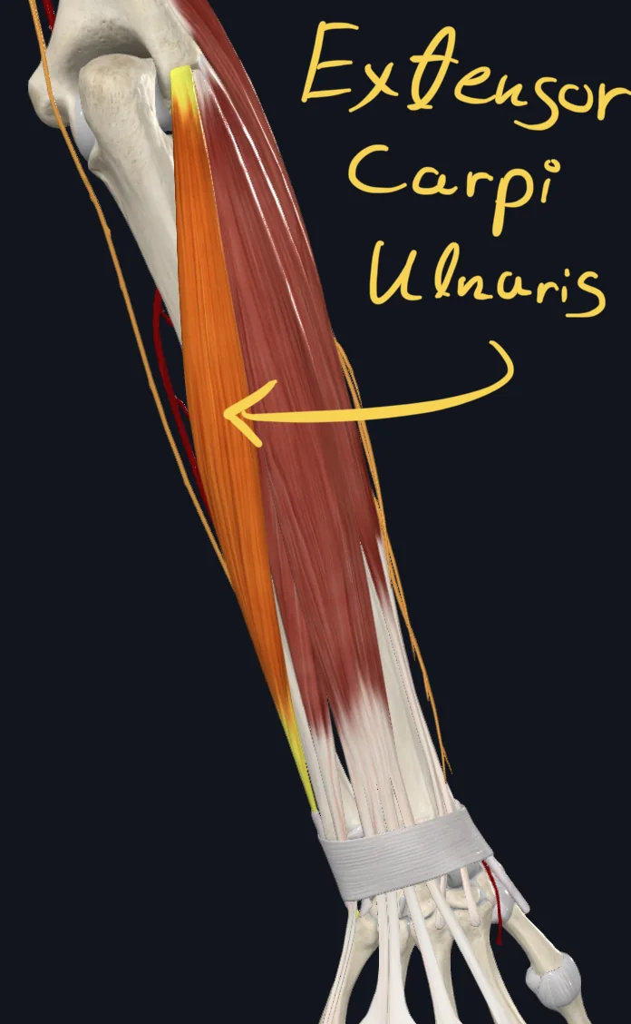 Extensor Carpi Ulnaris