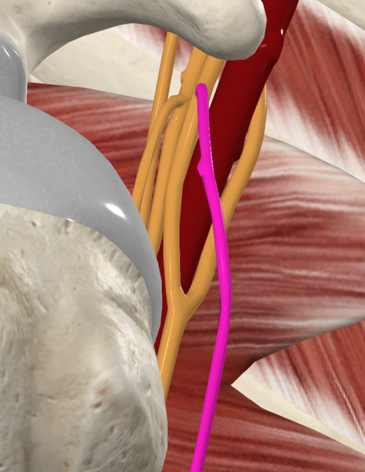 Musculocutaneous Nerve (Right) - up