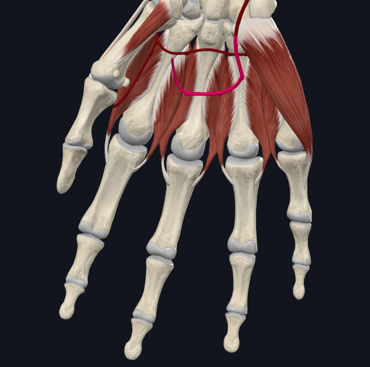 Superficial Palmar Arch (Right)