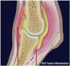 Joint Capsule