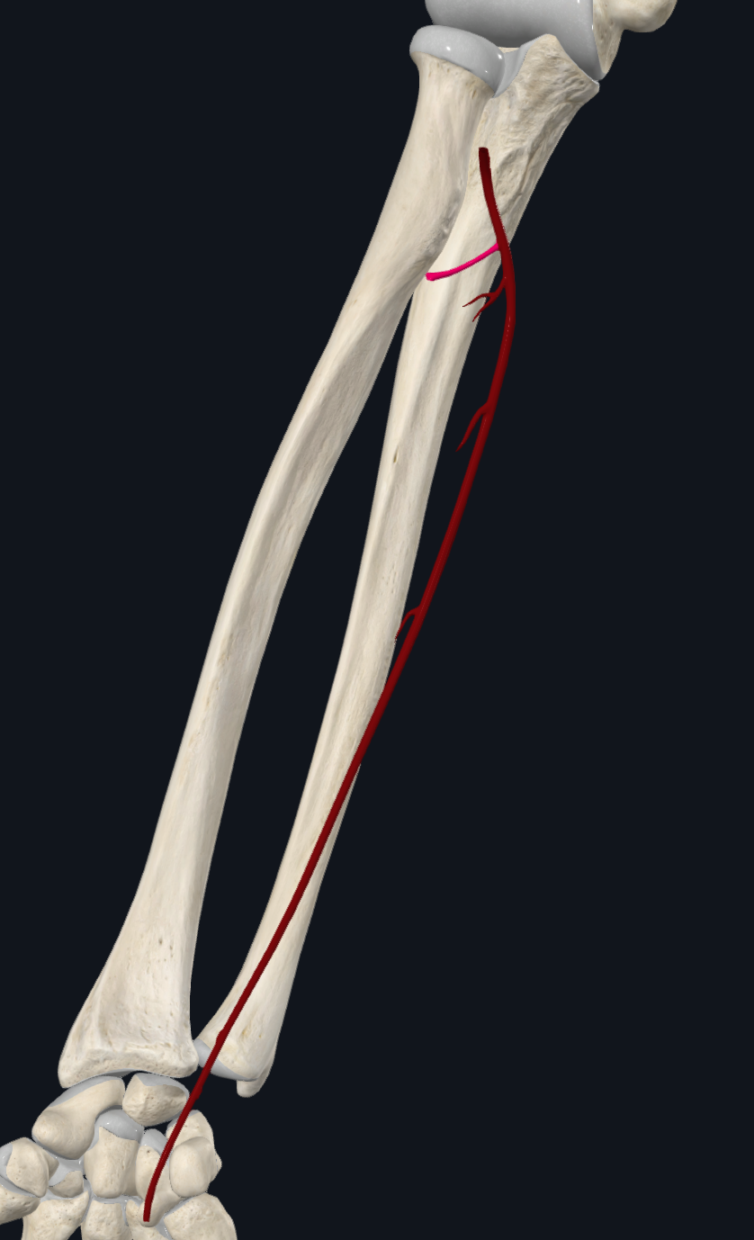 Common Interosseous Artery (Right)