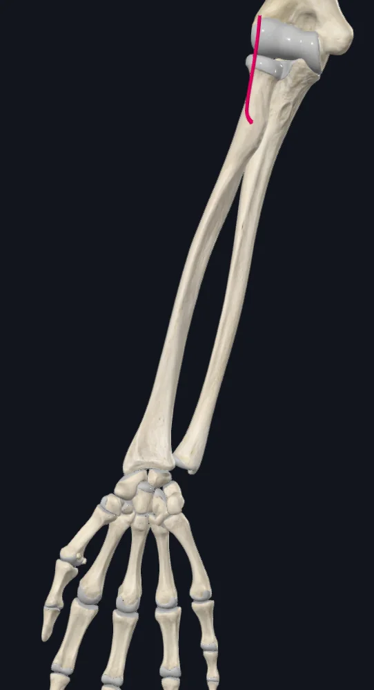 Radial Recurrent A