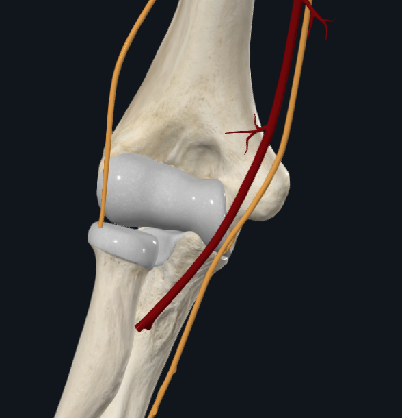 Cubital Fossa with Mdian Nerve, Brachial A, Radial Nerve