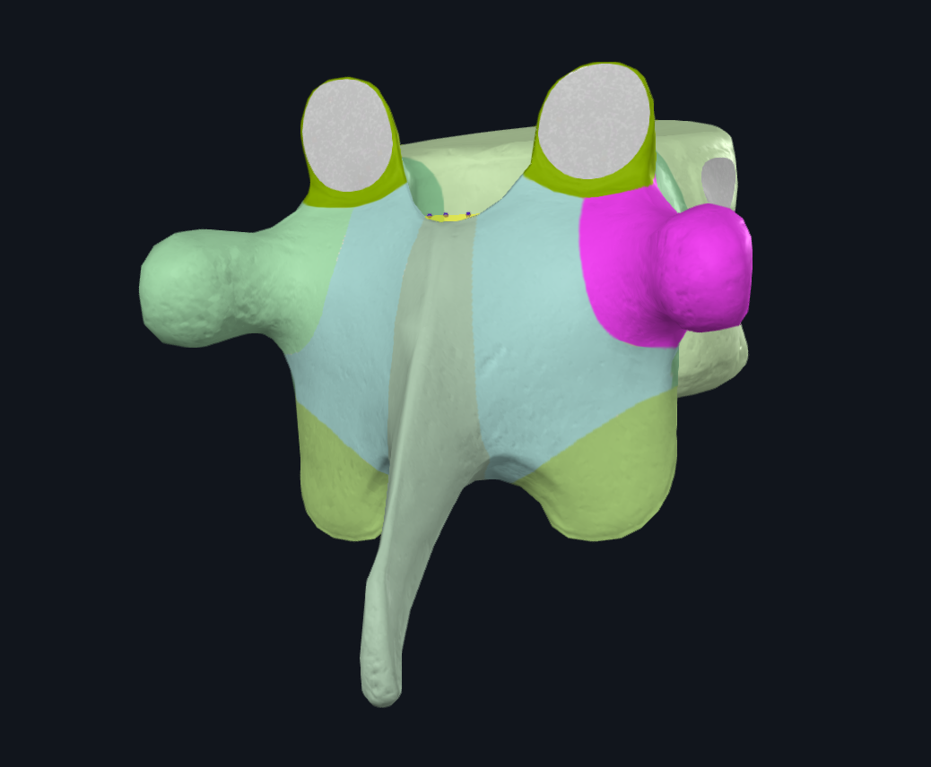 Transverse Process of Tenth Thoracic Vertebra (Right)