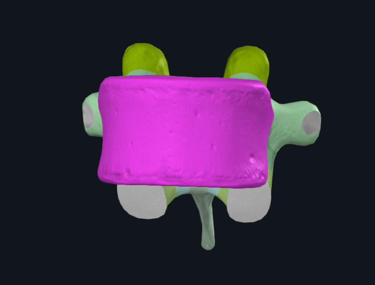 Vertebral Body of Tenth Thoracic Vertebra - side