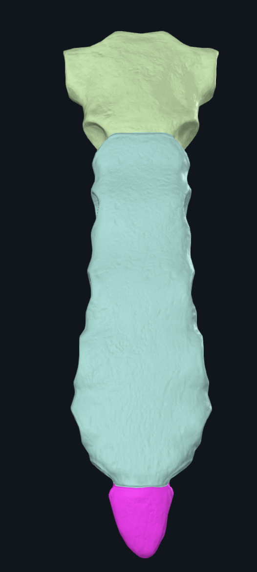 Xiphoid Process Processus xiphoideus