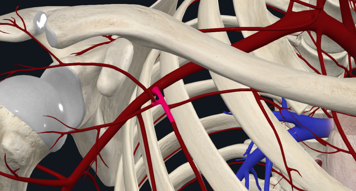 Thoracoacromial Artery (Right)