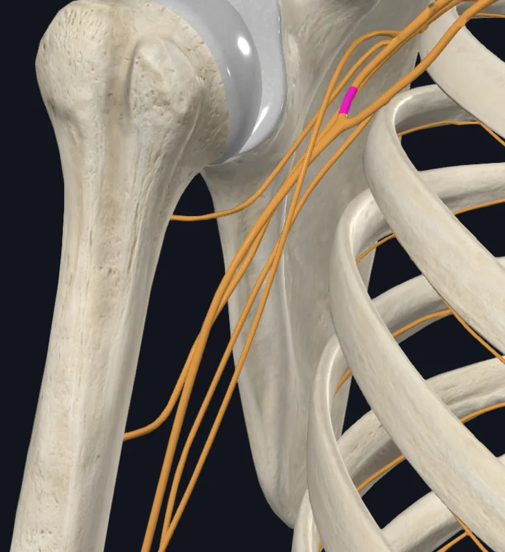 Lateral root of median nerve (Right)