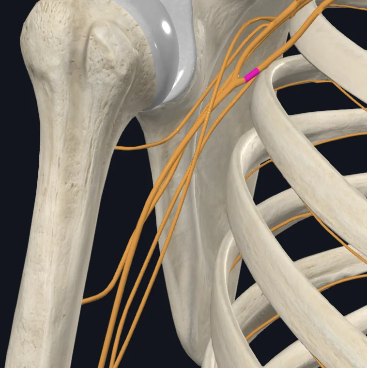 Medial root of median nerve (Right)