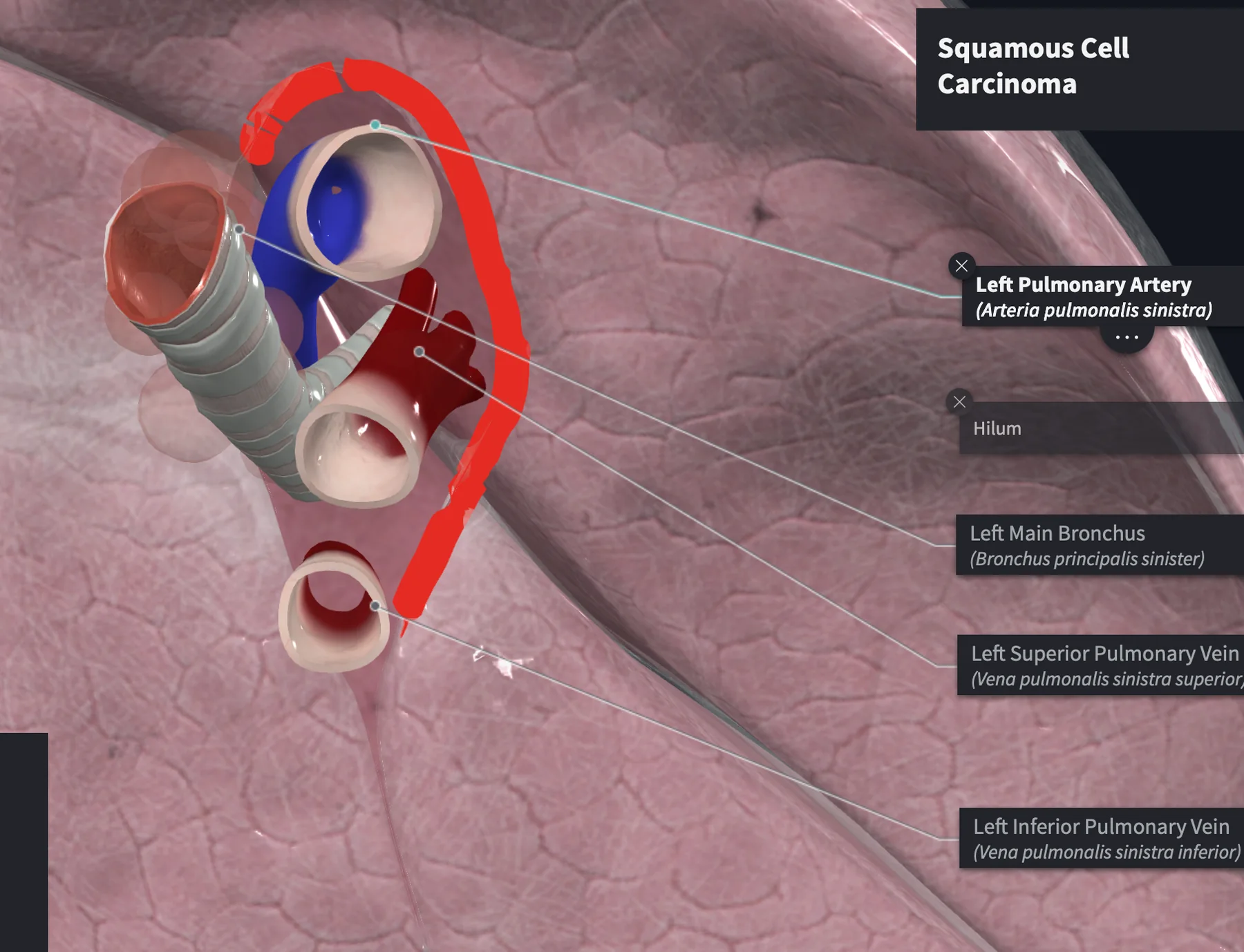 Bronchus relation to pulmonary artery