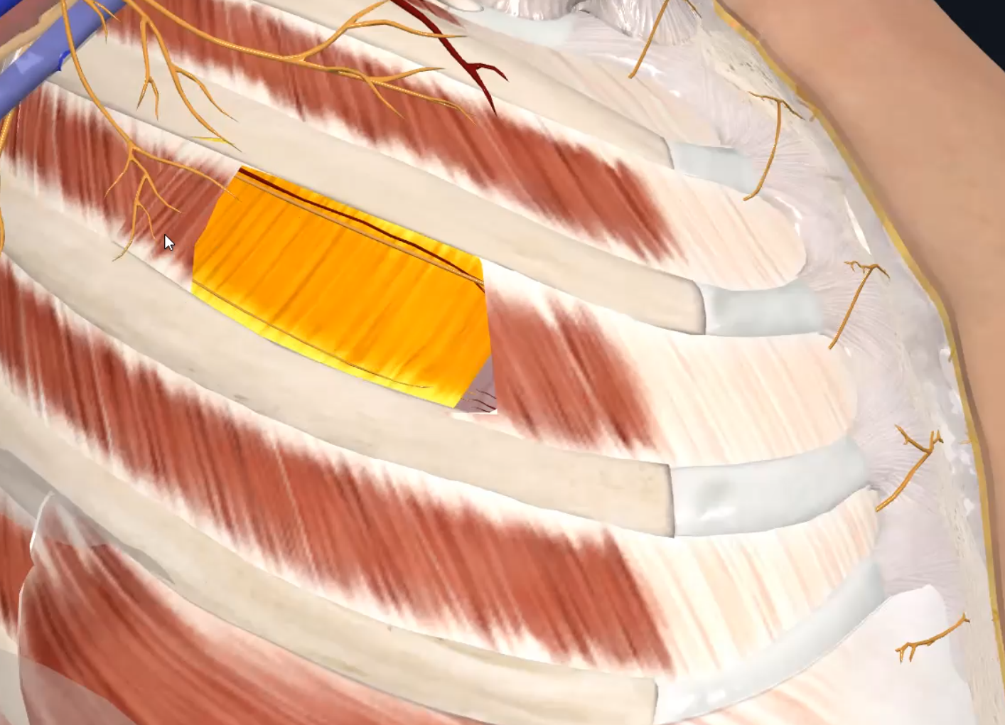 Innermost intercostal muscle (right)