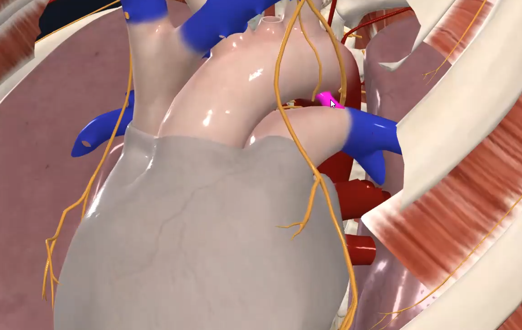 Ligamentum Arteriosum