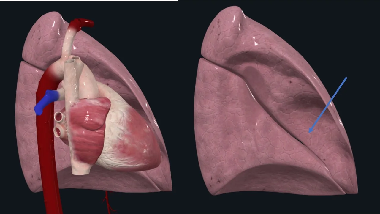 Cardiac impression