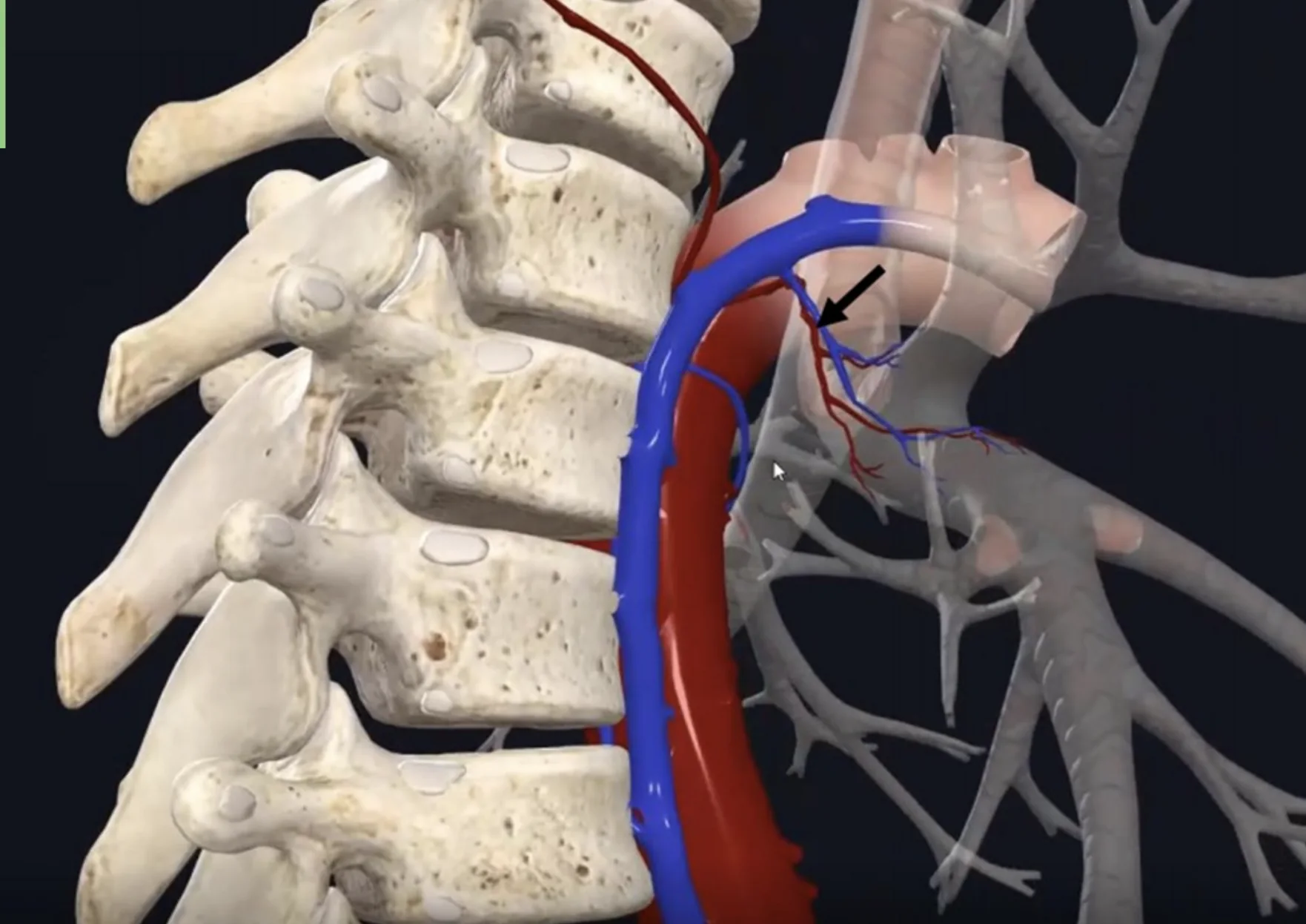 Bronchial a.