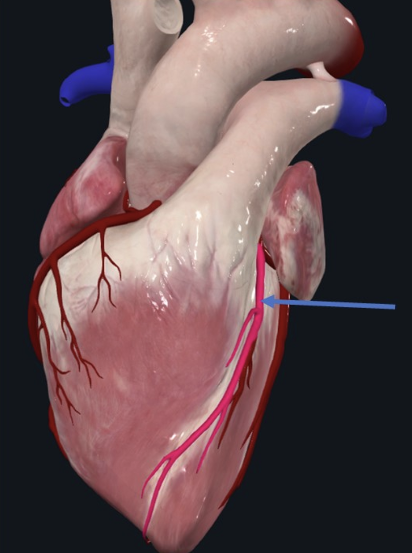 Left anterior descending artery (LAD)