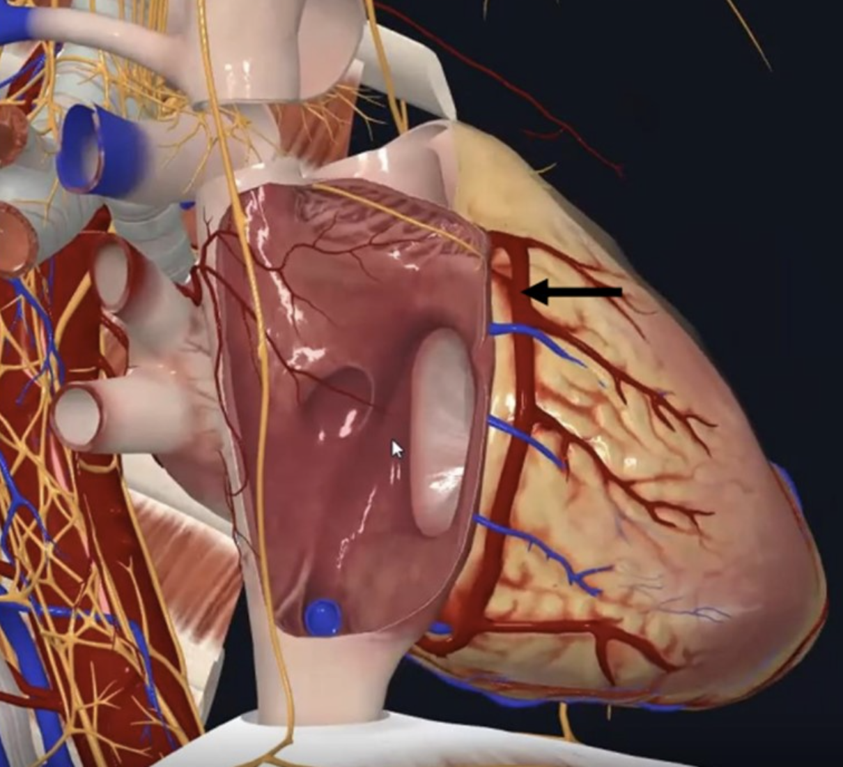 Right Coronary Artery