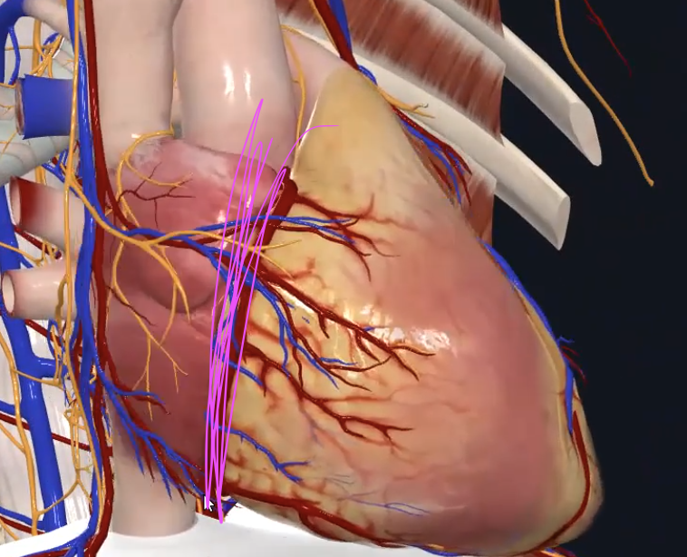 Coronary sulcus (atrioventricular sulcus)