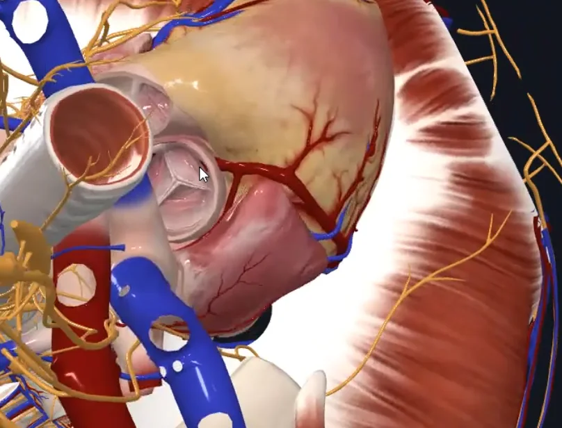Right Coronary a