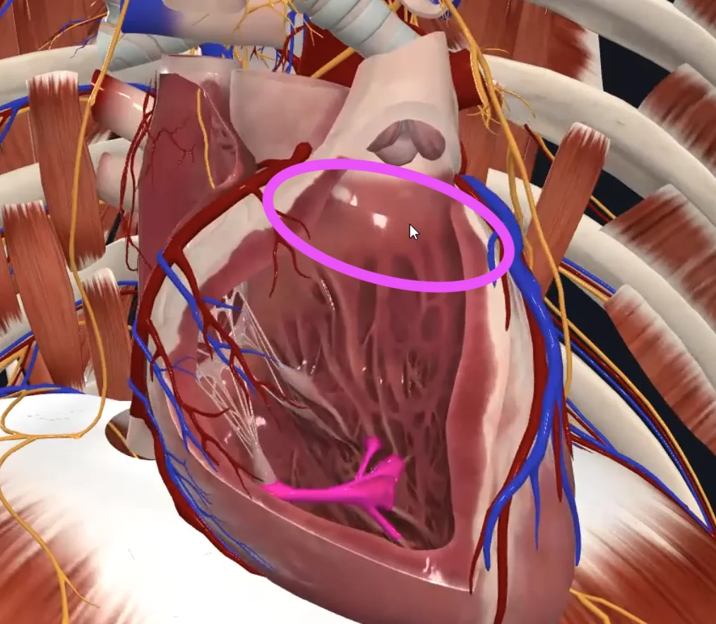 Conus Arteriosus