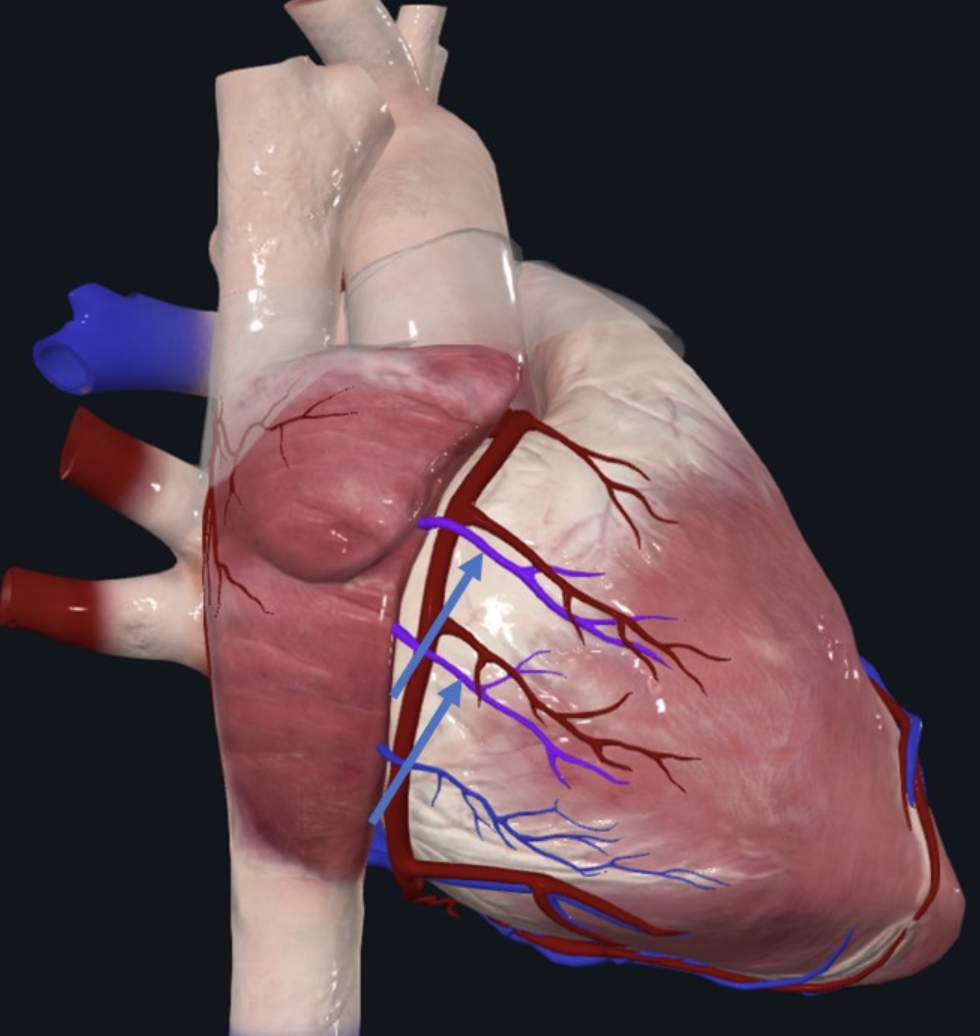 Anterior Cardiac v.