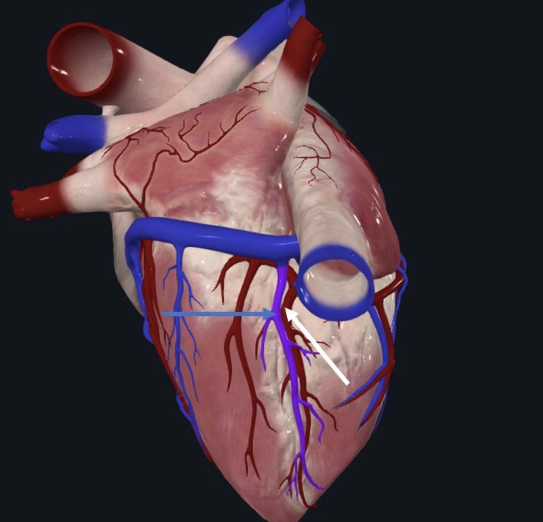 Middle cardiac vein