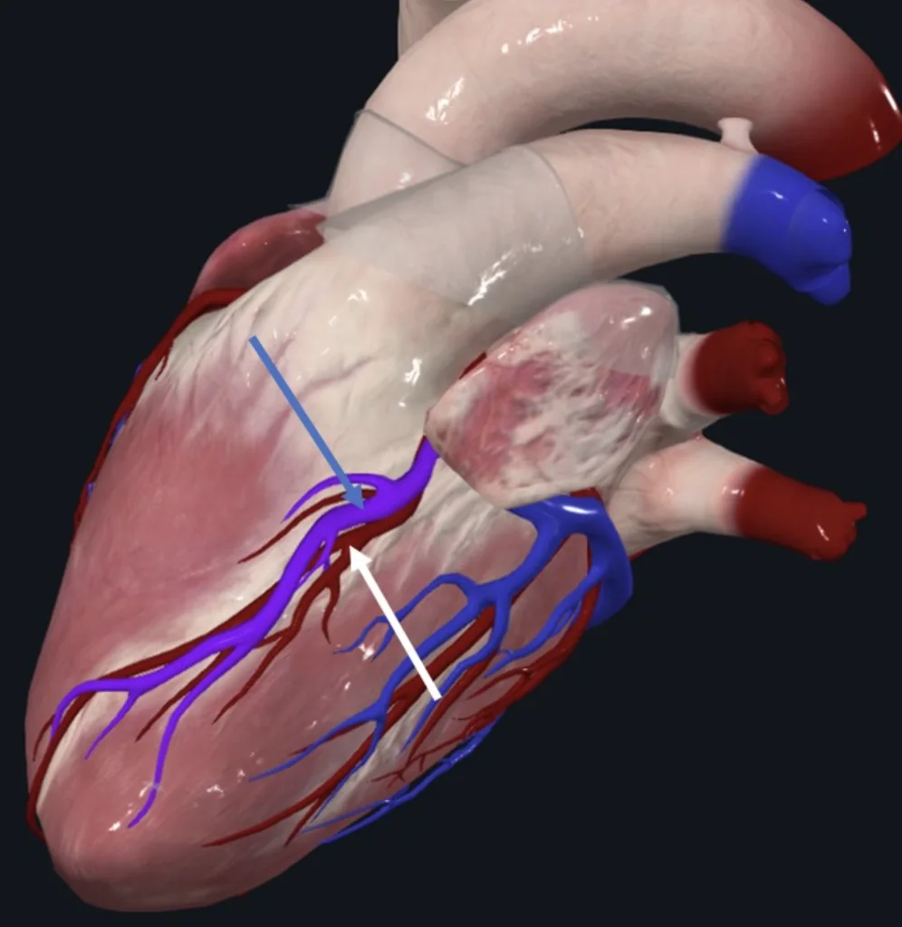 Great cardiac vein