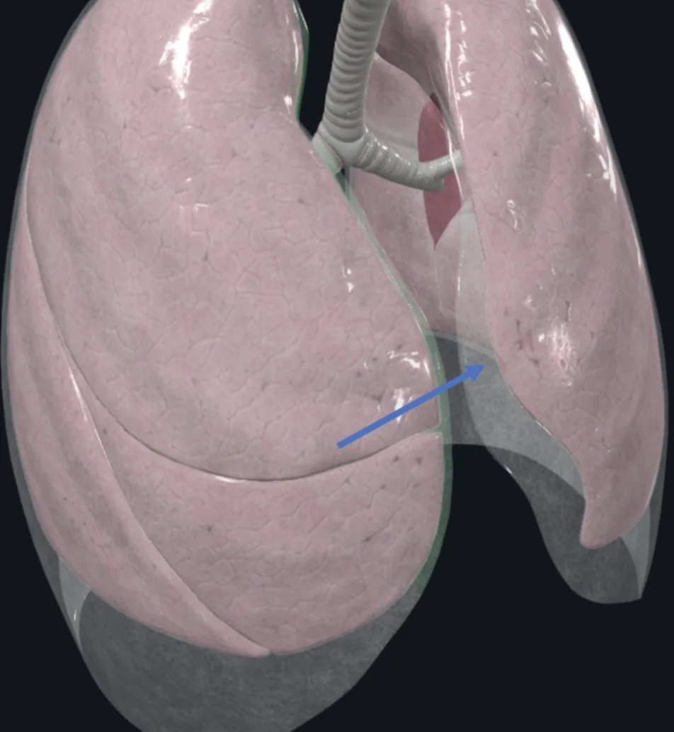 Costomediastinal recess