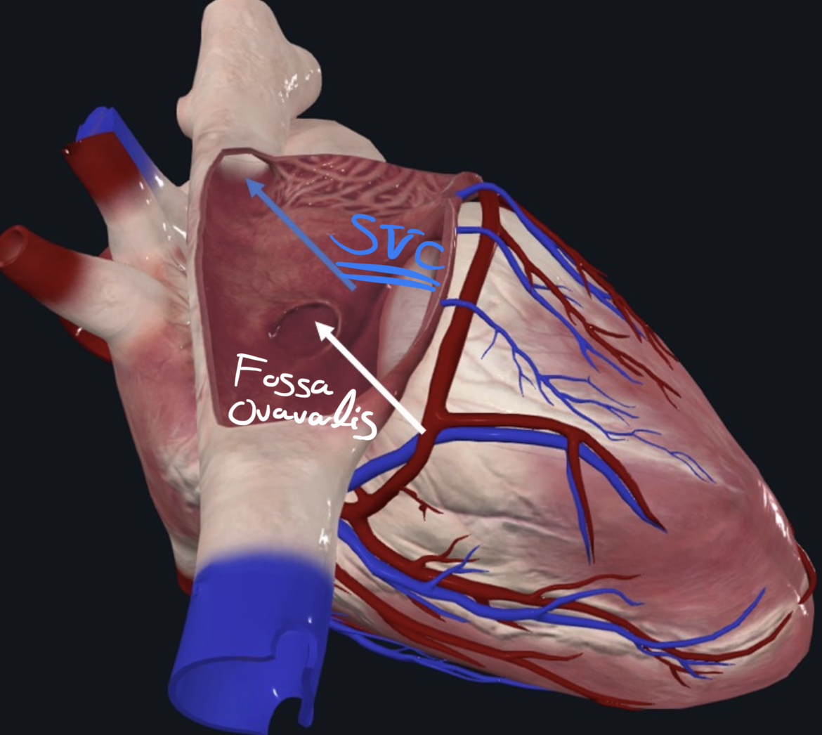 Superior Vena cava opening