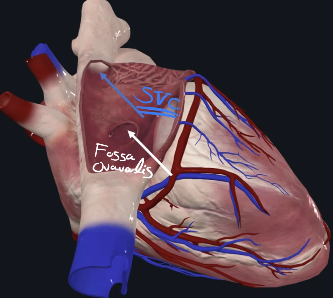 Superior Vena cava opening