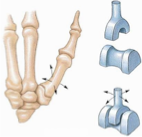 מפרק עצם המסרק מספר 1 (אגודל)