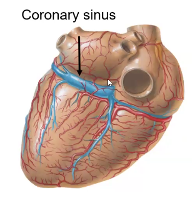 Coronary Sinus