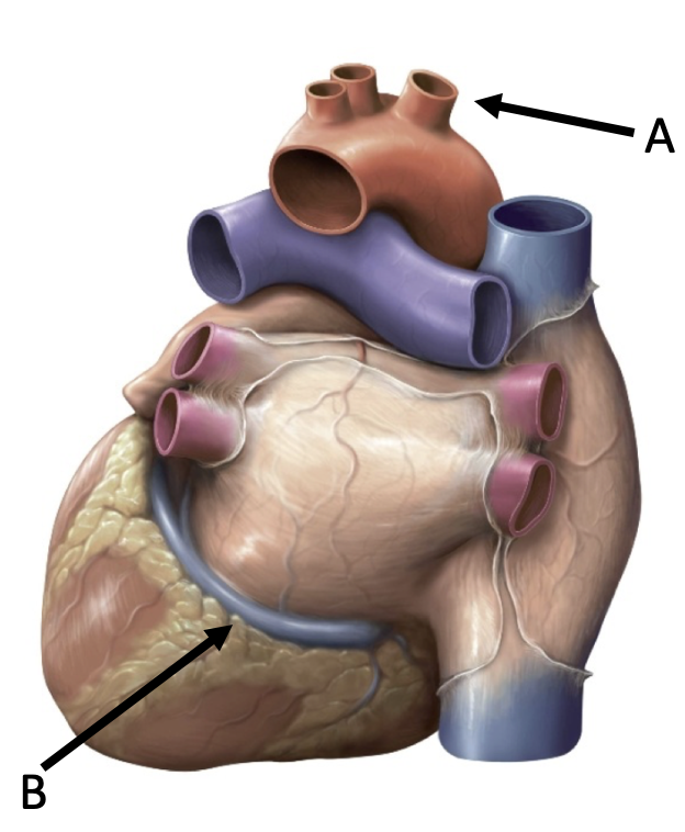 Thorax Mediastinum Quiz Question 21